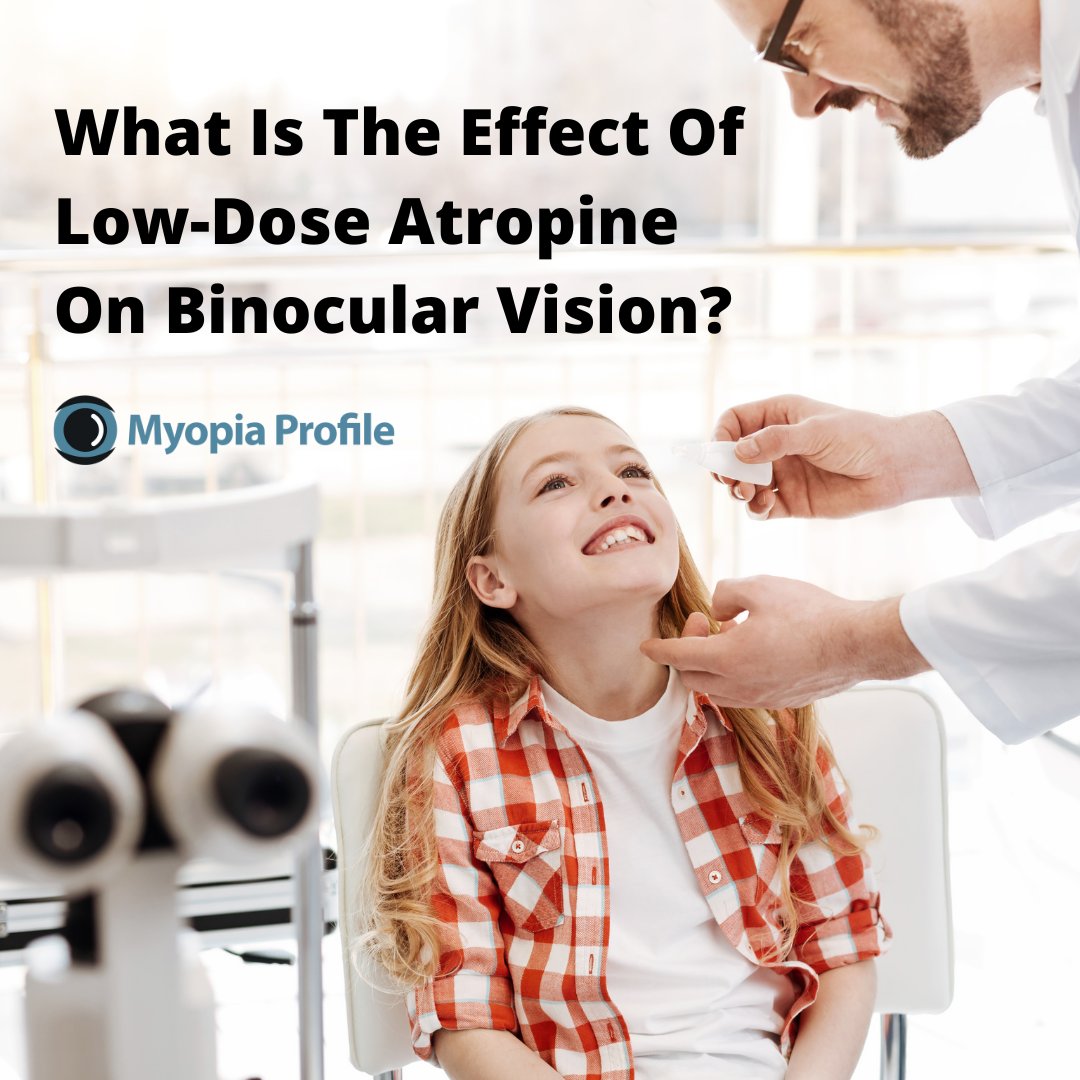 myopiaprofile's tweet image. Low-dose atropine (0.05% or less) has a maximum effect on pupil size for both bright and dim light conditions within an hour of instillation, but has little to no effect on binocular vision in myopic children when used for myopia management. myopiaprofile.com/low-dose-atrop…