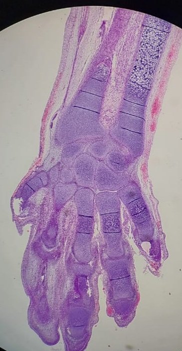 When your microscope lends you a 'helping hand'....🙂
Pic courtesy: Dr Deepa HC.