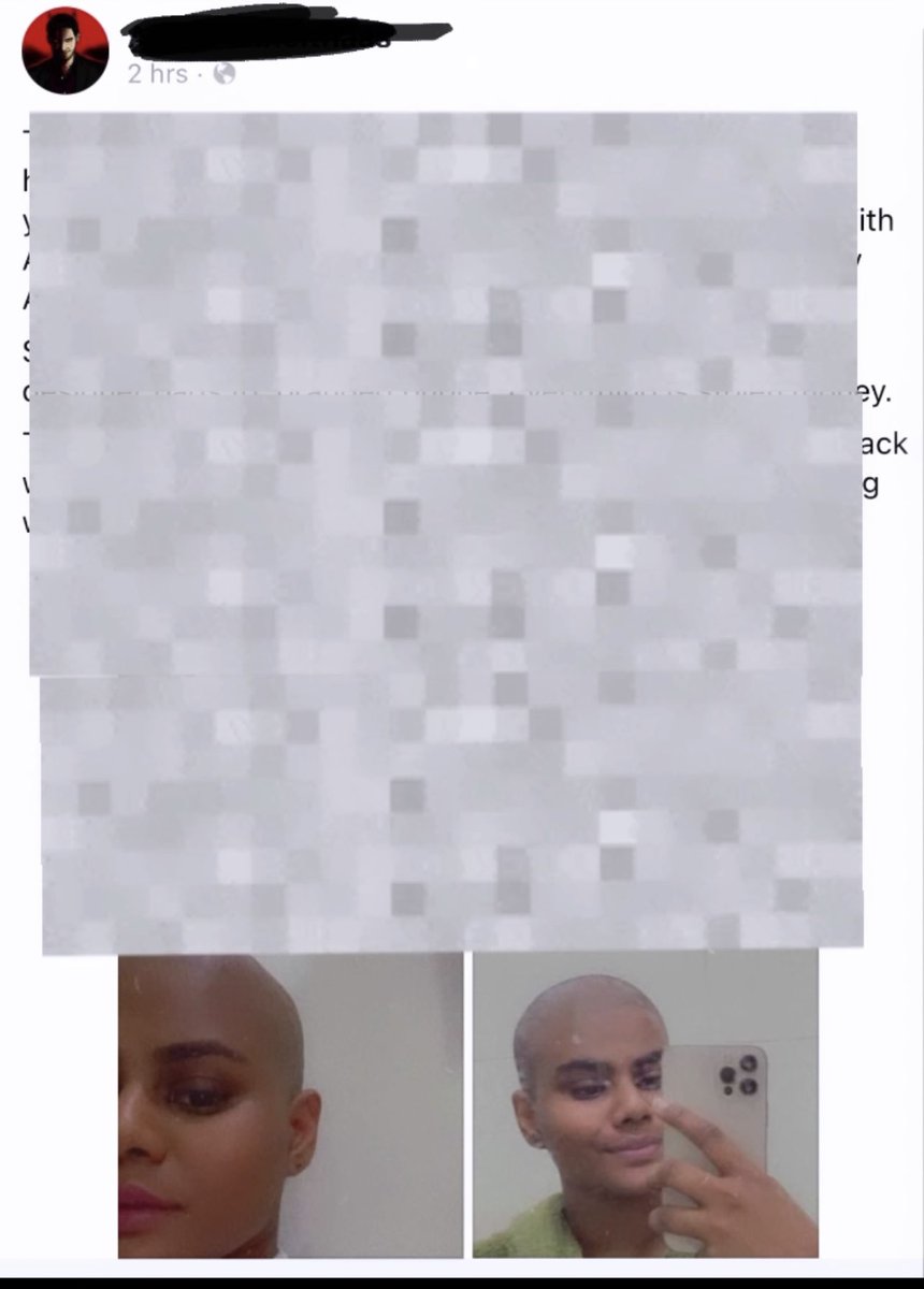 AslamLamha's tweet image. I never wanted to post these photos on any SM, even when someone has been trying so hard to trigger me by posting these on several pages. But its enough. These photos of mine were taken at a very vulnerable place in my life. And it’s pure evil to use these to attack me! 1/3