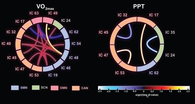 In #openaccess #BPLjournal 7:2, Jarrahi et al. linked VO2max measures with connectivity in networks impaired in #Parkinsons. Cardio was linked with increased functional connectivity between somatosensory motor and cognitive networks. 

Read it here: content.iospress.com/articles/brain…