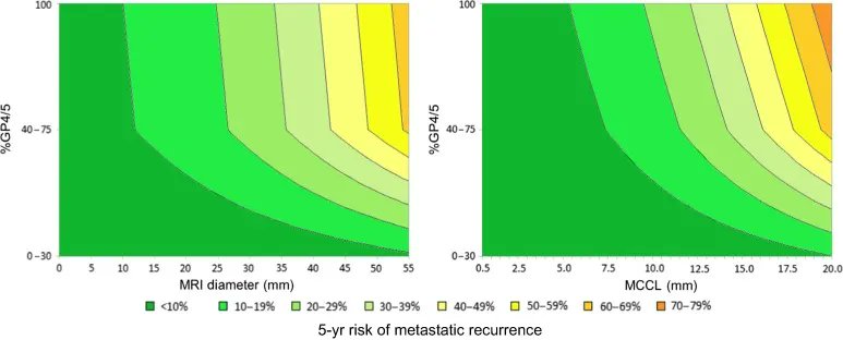 EurUrolOpen's tweet photo. Current Issue: Risk Estimation of Metastatic Recurrence After Prostatectomy: A Model Using Preoperative Magnetic Resonance Imaging and Targeted Biopsy

https://t.co/bpBWsHO0lB

@TBommelaere @ArnauldVillers @voxelmator @GPloussard @jo_olivier85 

#MRI #OpenAccess #openscience https://t.co/vh51xp8mE1