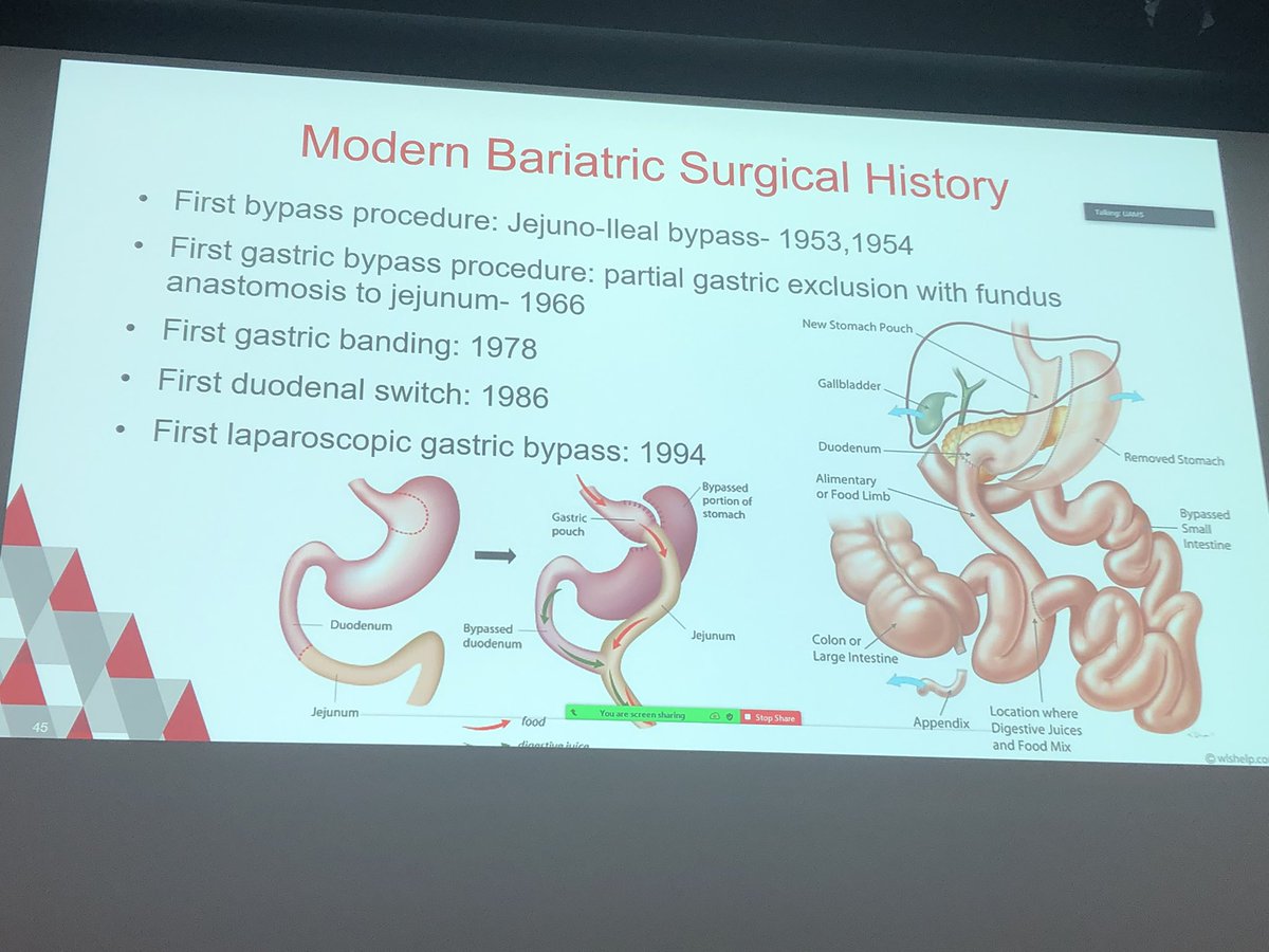 Dr. Joe Nigh PGY4 presenting a challenging case of choledocholithiasis post gastric bypass with entertaining historical anecdotes as well. #ARSurgeons22
