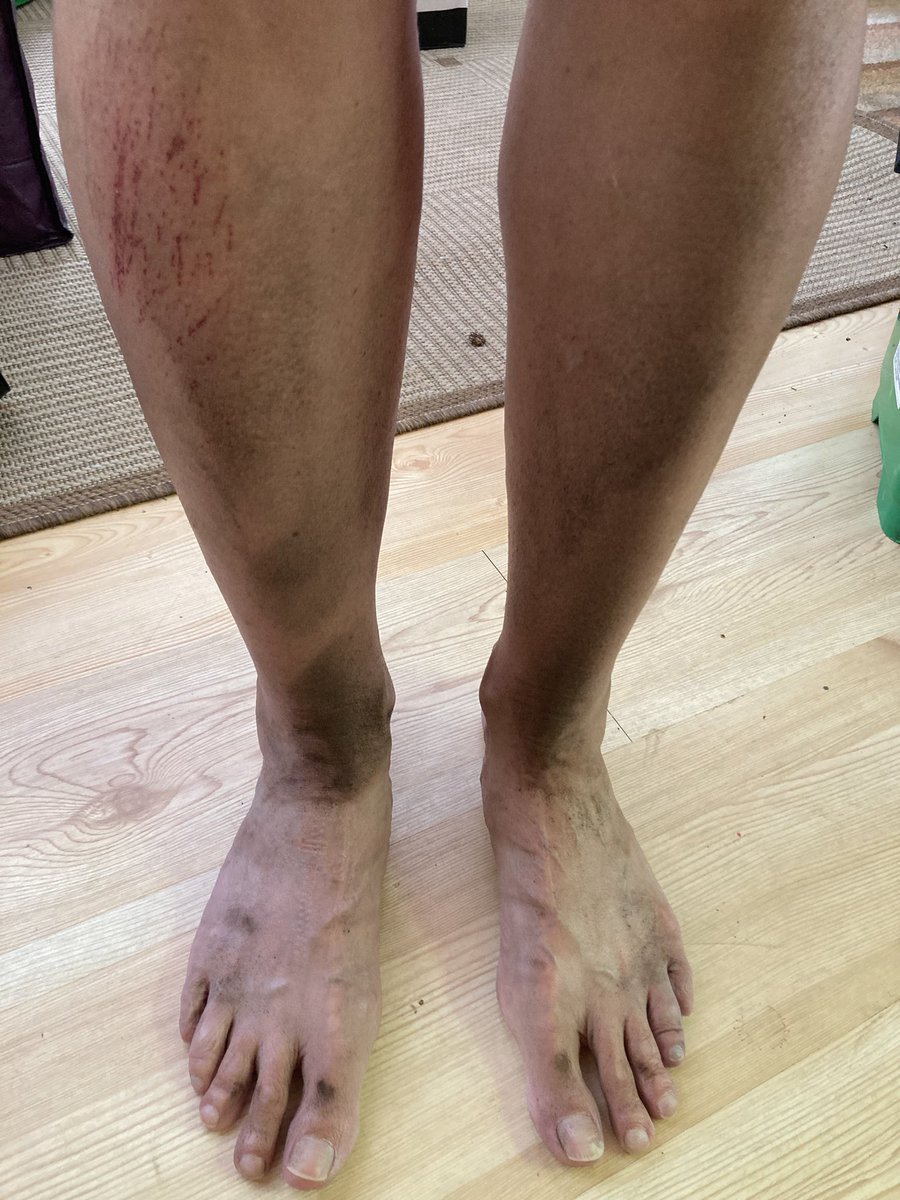 Great long weekend morning bike ride! It’s no fun unless you get dirty!