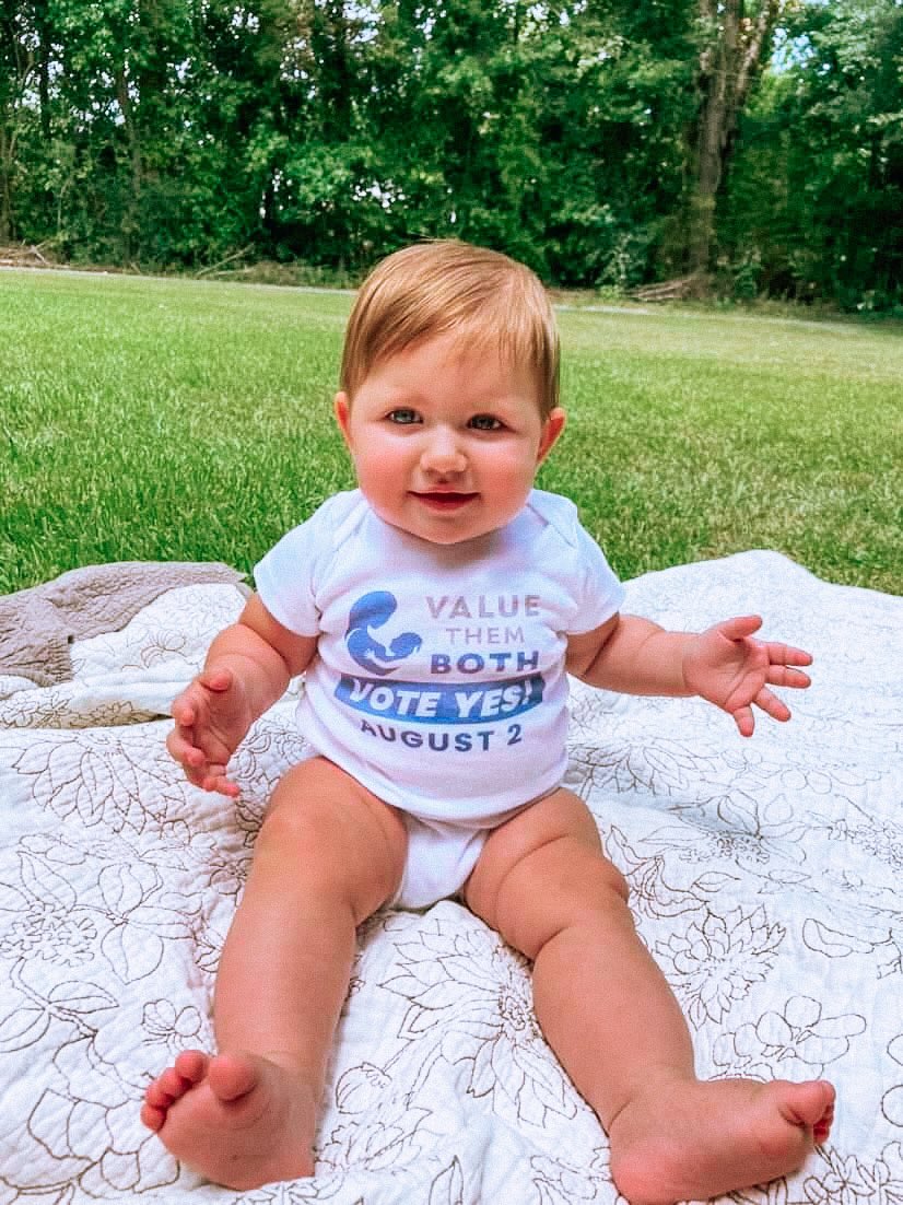 If you’re looking for a sign to vote YES on August 2nd, here it is. 😍