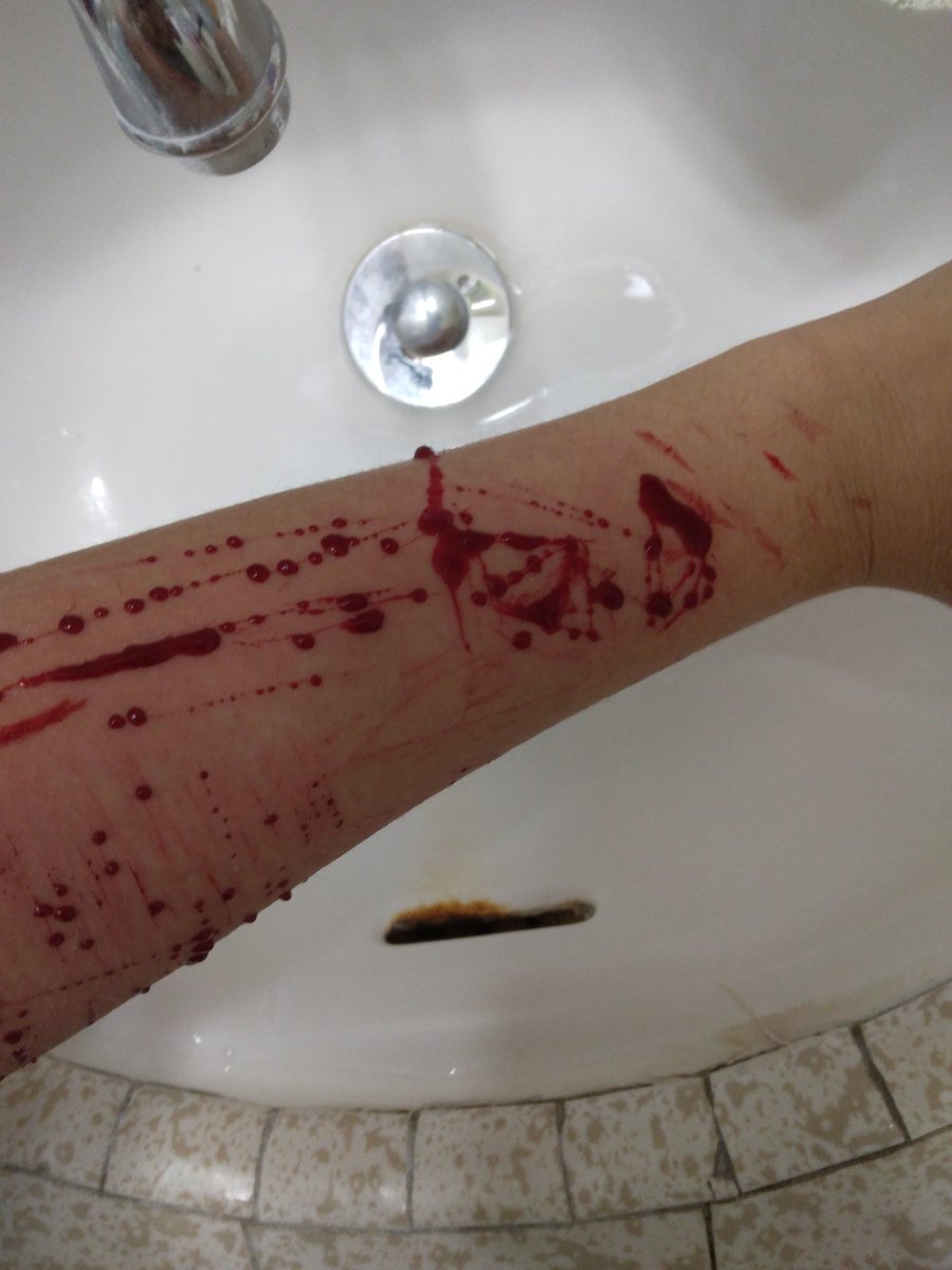 Mew_bunjiwoah27's tweet photo. Fake #dontreport #fake #tw #bodymakeup #gore #shtwt #triggerwarning #tw #edtwt https://t.co/dG7xm0BgyS