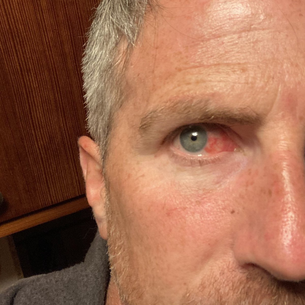 You'll shoot your eye out kid. And other reasons protective eyewear is recommended when, you know, doing stuff.