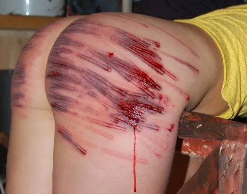 #BDSM #SadicaMente #MaleDom #Ass #Cane #Caning #Blood #Marks #Masochism #Pain #Punishment #Sadic #Signs<a href="/tag/bdsm"class="tags">#BDSM</a><a href="/tag/sadicamente"class="tags">#SadicaMente</a><a href="/tag/maledom"class="tags">#MaleDom</a><a href="/tag/ass"class="tags">#Ass</a><a href="/tag/cane"class="tags">#Cane</a><a href="/tag/caning"class="tags">#Caning</a><a href="/tag/signs"class="tags"><span>#signs</span></a><a href="/tag/blood"class="tags"><span>#blood</span></a><a href="/tag/sm"class="tags"><span>#sm</span></a><a href="/tag/masochism"class="tags"><span>#masochism</span></a><a href="/tag/pain"class="tags"><span>#pain</span></a><a href="/tag/punishment"class="tags"><span>#punishment</span></a>