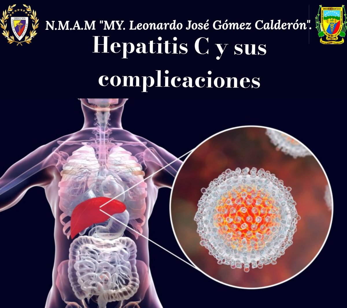 NMAMMYLEONARDO1's tweet photo. #19JUL Cuáles son las complicaciones de la hepatitis C? Sin tratamiento, la hepatitis C puede llevar a cirrosis, insuficiencia hepática y cáncer de hígado. El diagnóstico y tratamiento temprano de la hepatitis C puede prevenir estas complicaciones.
@DigesaludFANB https://t.co/WyLz9u4b8m