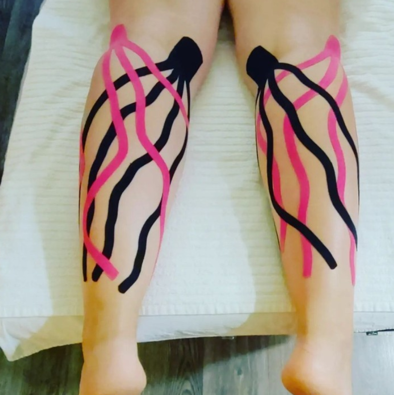 Kinesio_UK's tweet photo. #REPOST
#Kinesiotapingmethod used on the lower leg for swelling.
A great application by @karonaishi https://t.co/x2xFiZ9HFU