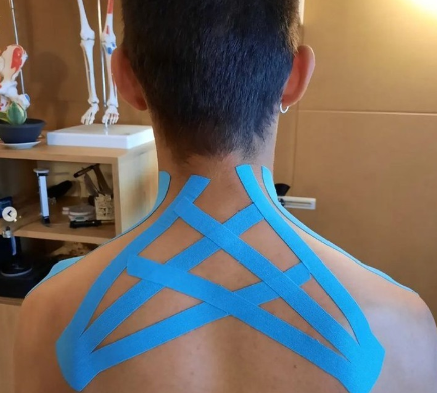 Kinesio_UK's tweet photo. #Repost
Fantastic taping by @htlaspezia
#Kinesiotapingmethod https://t.co/4YAIjGA8Qb