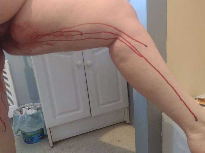 Period Soaked Hairy Bloody Pussy 🌹 https://t.co/wTsSSpS8nQ<a href="/tag/bbw"class="tags"><span>#bbw</span></a><a href="/tag/pawg"class="tags"><span>#pawg</span></a><a href="/tag/milf"class="tags"><span>#milf</span></a><a href="/tag/bigbootywoman"class="tags"><span>#bigbootywoman</span></a><a href="/tag/bbwvideo"class="tags"><span>#bbwvideo</span></a><a href="/tag/sc"class="tags"><span>#sc</span></a>