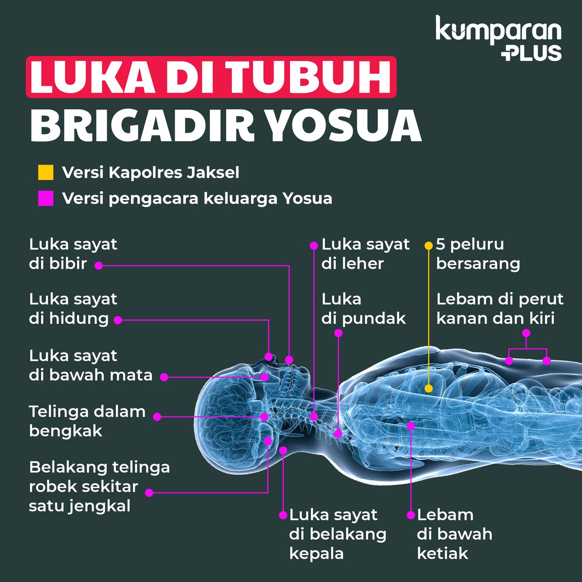 kumparanplus's tweet photo. Pengacara keluarga Yosua, Kamaruddin Simanjuntak, menjabarkan berbagai luka di tubuh korban kepada kumparan pada Minggu (17/7). Ia mengakui memang ada lubang-lubang bewarna hitam bekas peluru seperti keterangan Kapolres Jaksel Kombes Budhi Herdi Susianto.

#BrigadirYosua https://t.co/LASO0wcBvZ