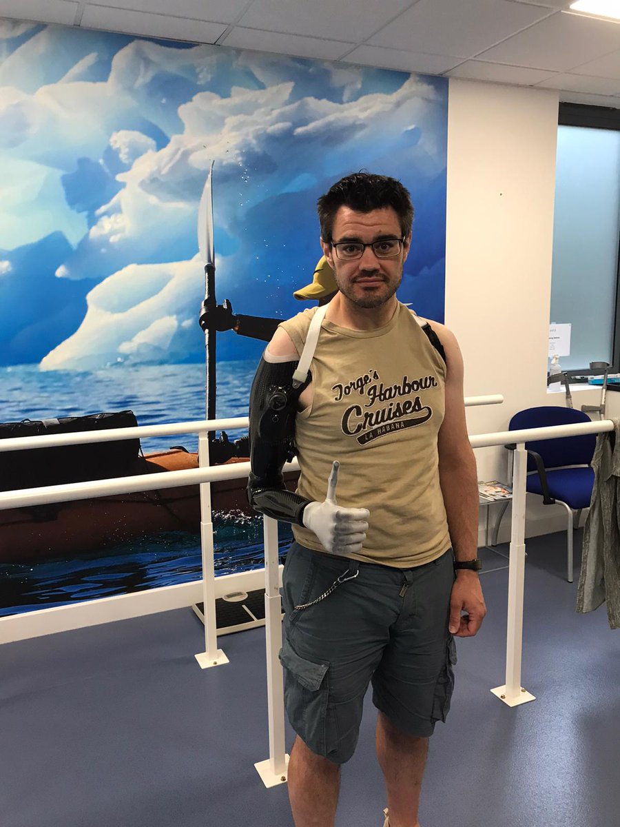 PaceRehab's tweet photo. How easy does Ben make his new prosthesis look? A mix of collaborations using the best of upper limb technology from a number of different companies. Full details can be found here:
https://t.co/rTaTC0bBVN #thumbsup @OssurCorp  @FillauerCo  @orthoeurope @SteeperGroup @Ben_C_Dodds https://t.co/GHsJ5TGrBL