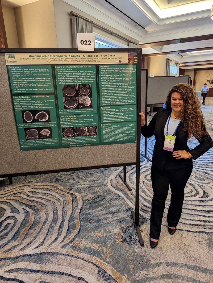 Krishna Nallamshetty, MD, FACR (@knallammd) on Twitter photo (1/2) Proud of our Morsani College of Medicine <a href="/usfradiology/">USF Radiology - Residency & Fellowship</a> residents who showcased their #research at the Florida Radiological Society Meeting this past weekend!
#medicine <a href="/floridarad/">Florida Radiological Society</a> #FRS2022 #radres #radiology <a href="/USFHealth/">USF Health</a> <a href="/RadiologyACR/">American College of Radiology</a> <a href="/ACRRFS/">ACR RFS</a> (1/2) Proud of our Morsani College of Medicine <a href="/usfradiology/">USF Radiology - Residency & Fellowship</a> residents who showcased their #research at the Florida Radiological Society Meeting this past weekend!
#medicine <a href="/floridarad/">Florida Radiological Society</a> #FRS2022 #radres #radiology <a href="/USFHealth/">USF Health</a> <a href="/RadiologyACR/">American College of Radiology</a> <a href="/ACRRFS/">ACR RFS</a>