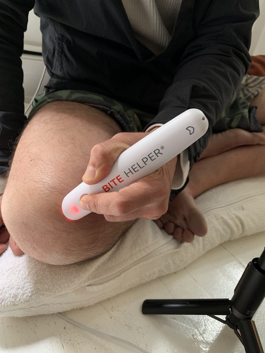 TheBiteHelper's tweet image. Got an itchy bug bite? 
Forget about messy anti-itch creams. 
Just use Bite Helper - itch neutralizer powered by Thermo-Pulse-technology to get rid of the itch for good! Get one today: 

#mosquitoes #mosquitobites  #natureinspried #BiteHelper #itch #summer #summer2022 #insects