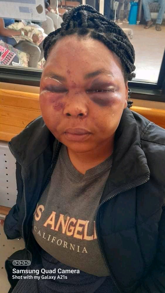 freshbylullo's tweet photo. I just saw this on Facebook 💔💔

" Lo bhuti ngu Silulami Madikizela uhlala eNkanini settlements eKhayelitsha. 
Friday he called us as oSisi baka Yamkela esithi ulahlekile, kanti umfumbe eHokini uyazinika kuye, phofu  ubethelwa ubuya after 20H00pm endlini," 1/2 https://t.co/3Jctk4b6g8