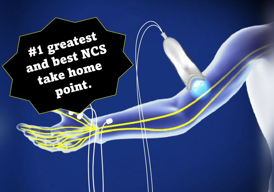 zach_london's tweet photo. Who wants to know the most important crucial critical high yield thing about nerve conduction studies? 
Once you learn this concept, everything else in your life will fall into place. You may "find yourself," at least in an electrodiagnostic sense.  #tweetorial 1/🧵 https://t.co/72BdlFmNt4