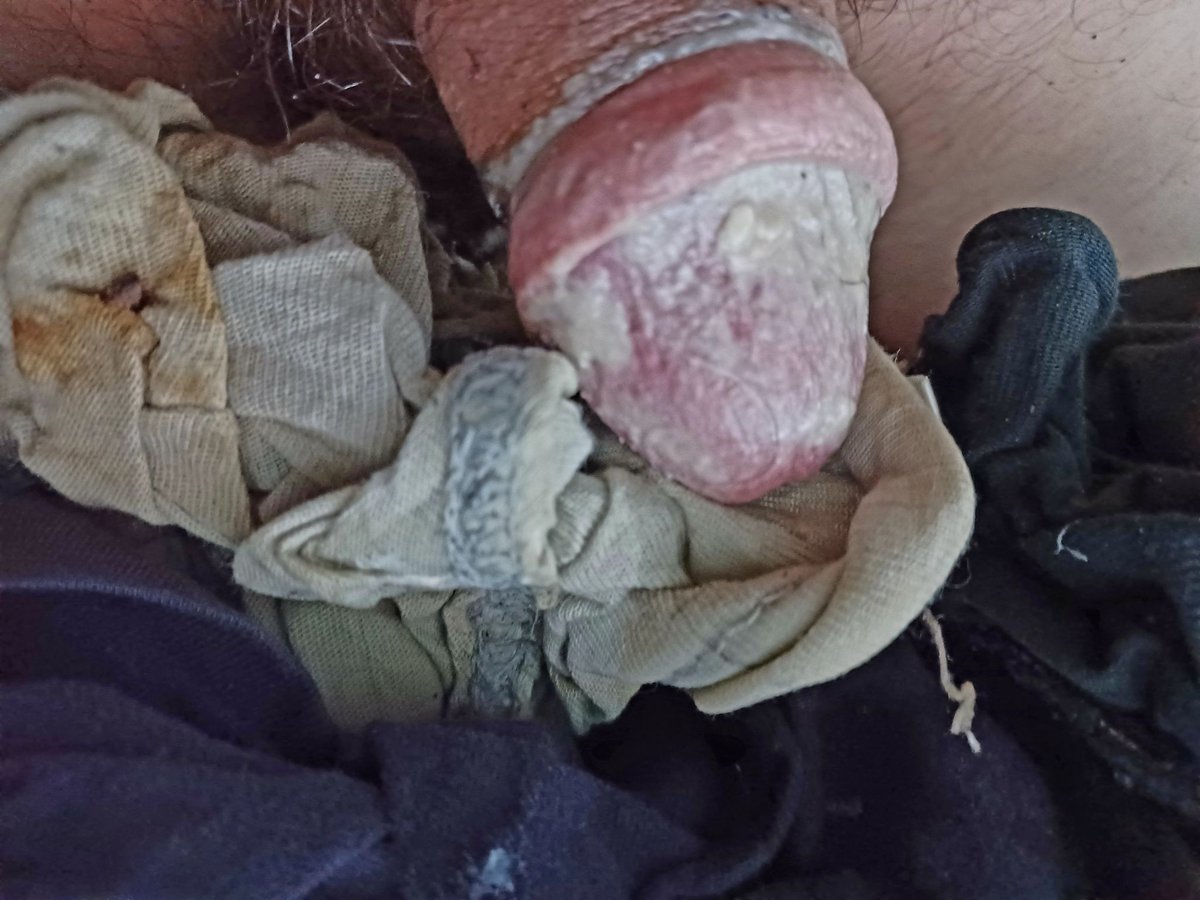 cheese_chub's tweet photo. #smegma #chub #feet #gaychub #raunch #cheesecock https://t.co/Fy2Y1cEKfc