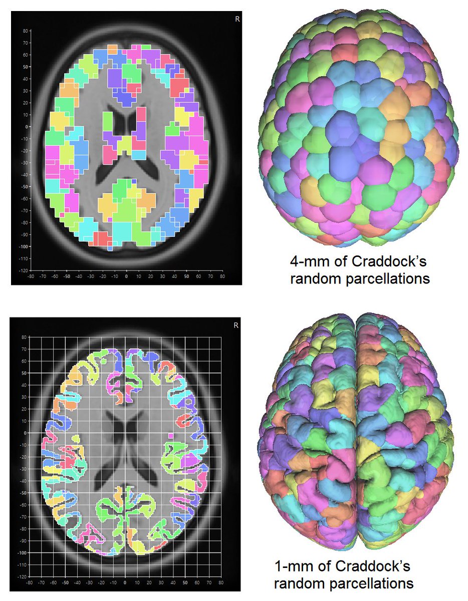 FangChengYeh's tweet photo. How to convert a low-resolution MNI parcellation to 1-mm ICBM152 space? 
Here's an example of 4-mm Craddock's random parcellation upgraded using #DSIStudio🧵(1/4) https://t.co/tt3TqCs9SR