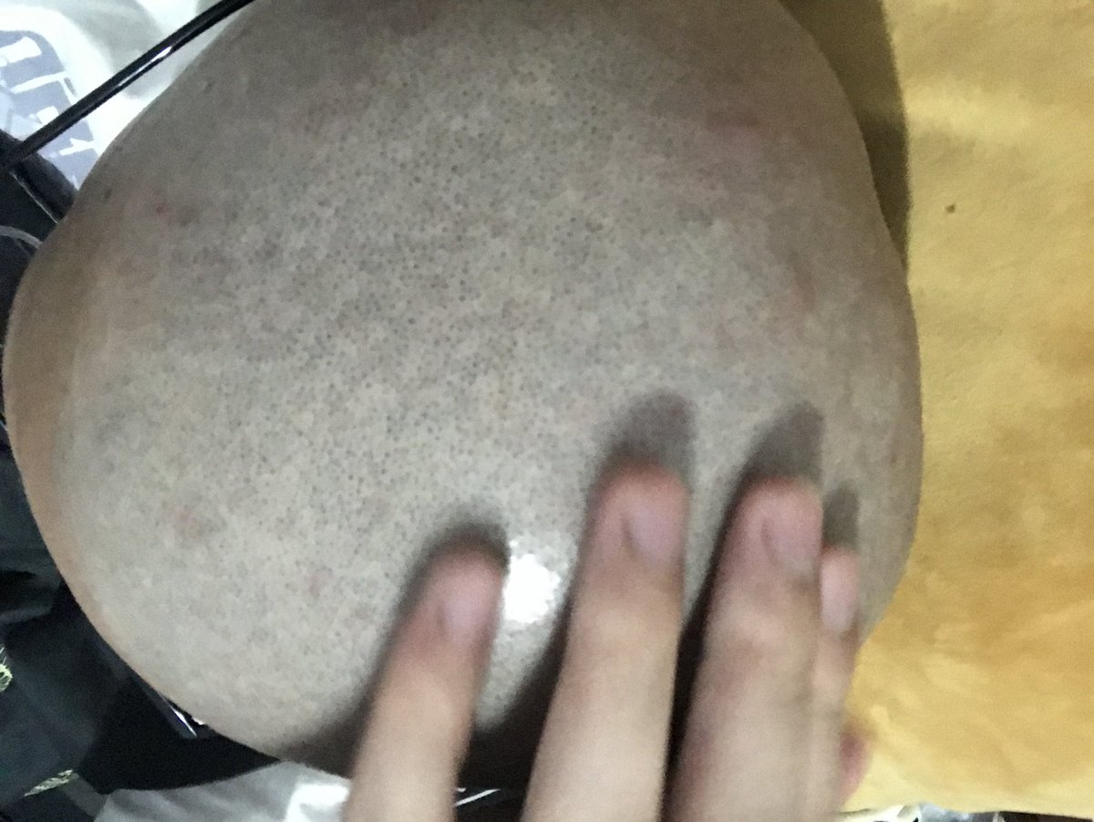 来看光头！特别好摸
#寸头 #光头 #剃头 #光头犬