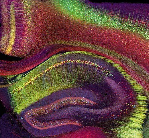 chrost_hugo's tweet photo. The perfect combination of art and science. The neurons of the rat's hippocampus.

By Tamily Weissman, Jeff Lichtman and Joshua Sanes (2005) / Abrams Books

#neuroscience #Biology #neurotwitter #Bioinformatics #biochemistry #Science #MedTwitter #ScienceTwitter #MedTwitter https://t.co/Lc2DnVnF5O
