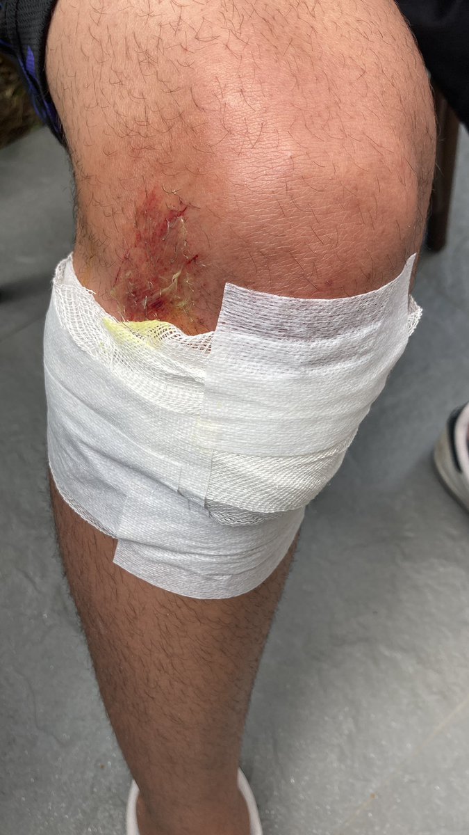 O kadar beddua boşa gitmedi içiniz rahat olsun