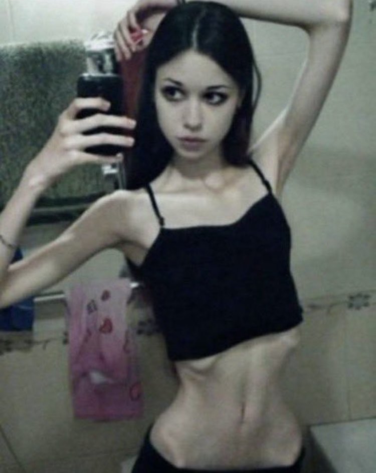 r0ttenc4lss's tweet image. only drinking a coffee today,i’m going to have a 4 days fast,any tips for not fainting (i have low iron)
Anyways this is one of my fav thinspo,literally goals. #edtwt #thinspo