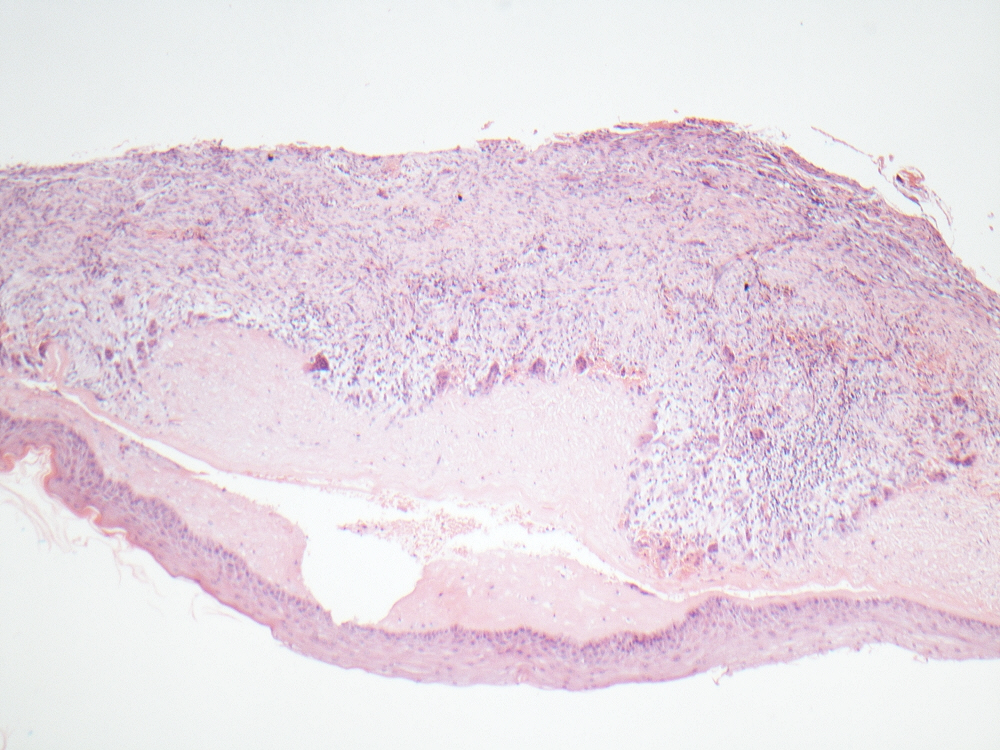 Oral Path Opinion tweet media