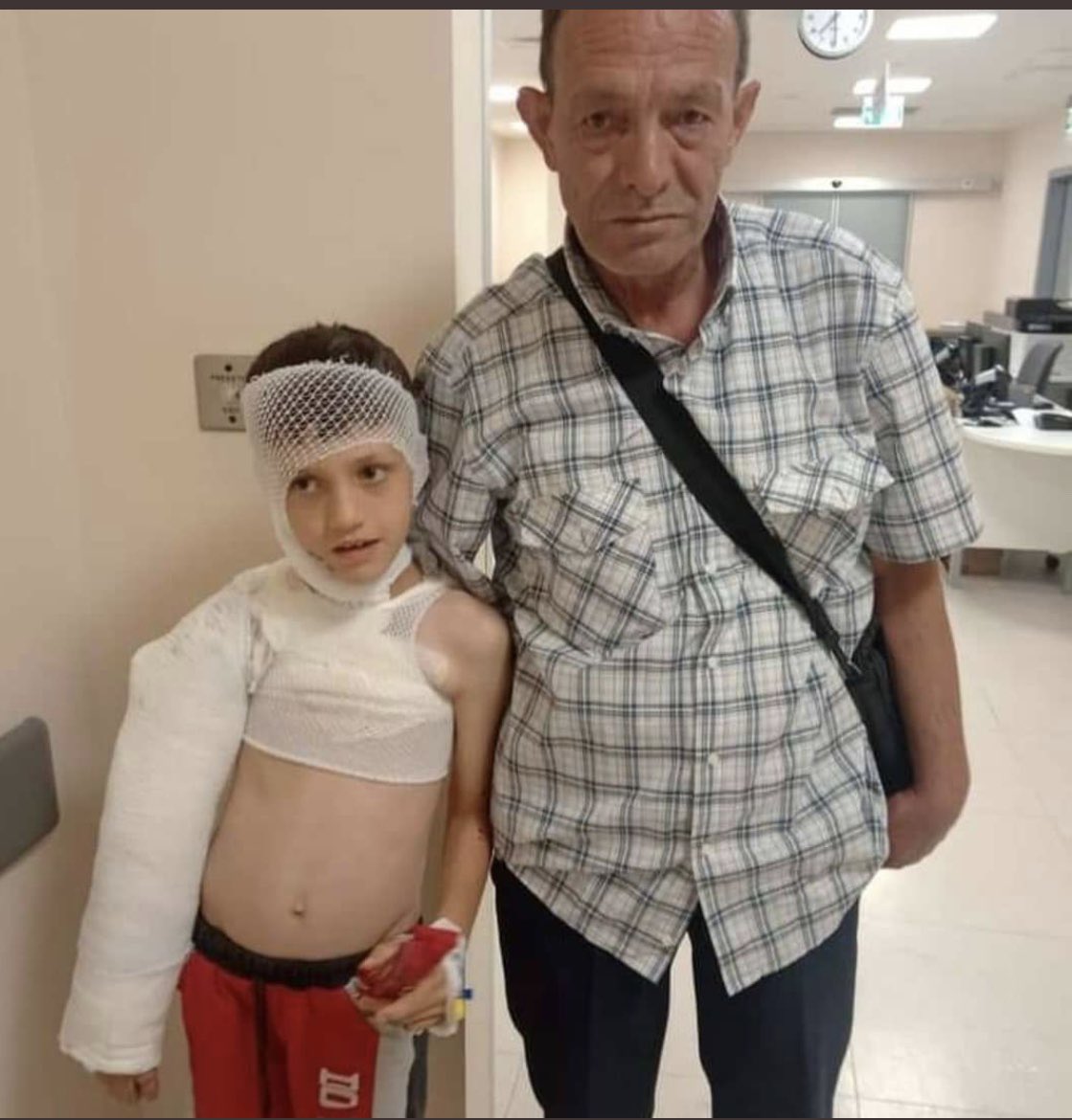 Bilgilendirme.
Yüzüne kezzap dökülen Yusuf için dün görevlendirme verilmiştik.
Hastane ile görüştük.
<a href="/TCKonyaValiligi/">Konya Valiliği</a> nin hastane ile ilgili tam teşekküllü desteği var. Ve bizzat ilgileniyorlar.
Medikal alımını Ahbap yaptı.
Ailesi ile de görüştük.
Teşekkür ediyorlar hepinize🙏