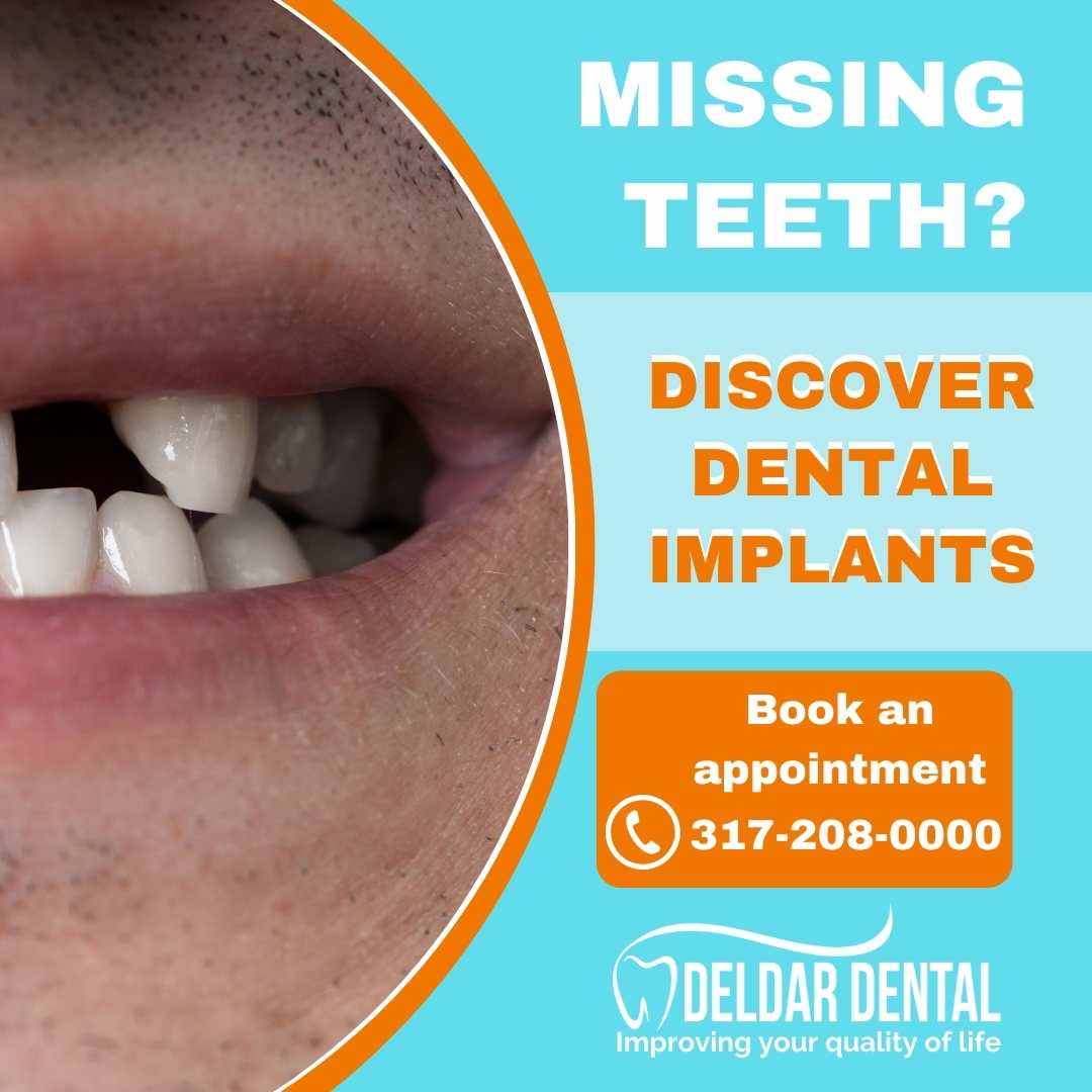 Are you looking for dental implants to fill the gap in your teeth?
Dental implants are a great and effective long term solution which should last many years with proper care.
Learn more at loom.ly/C95wqP0