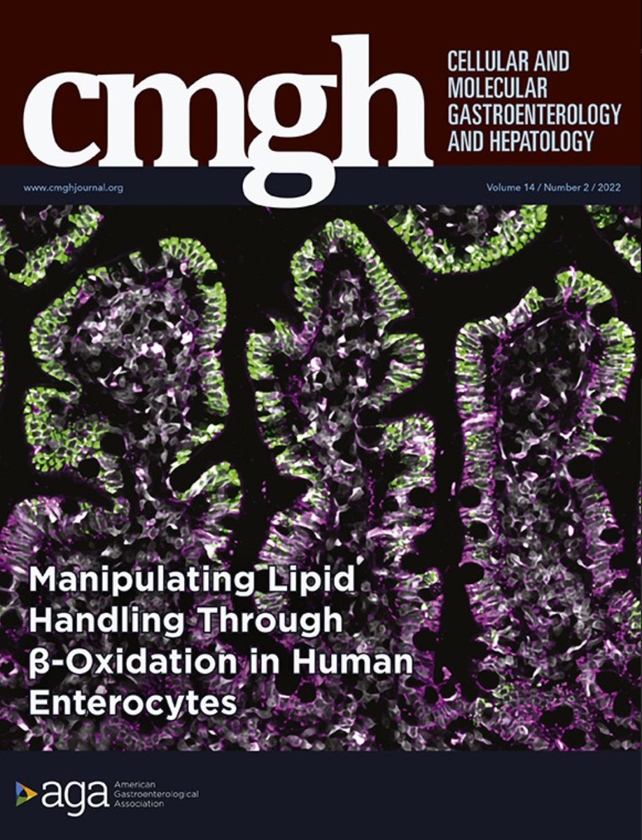 Magness Lab (@magnesslab) on Twitter photo Tired of not being able to access your organoid’s lumen? In our new CMGH publication, we developed a high-throughput 2D human enterocyte culture model for studying lipid transport and found that anti-diabetic drug metformin enhances fatty acid export via b-oxidation. Tired of not being able to access your organoid’s lumen? In our new CMGH publication, we developed a high-throughput 2D human enterocyte culture model for studying lipid transport and found that anti-diabetic drug metformin enhances fatty acid export via b-oxidation.