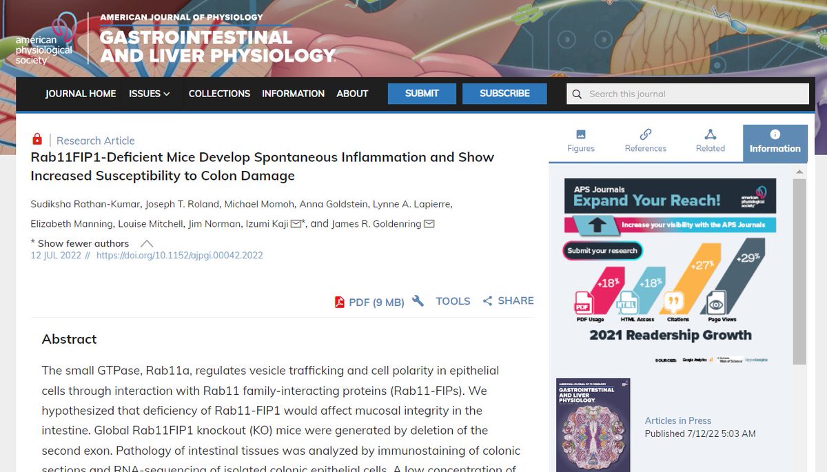 ajpgi's tweet photo. New research in #ajpgi "#Rab11FIP1-Deficient Mice Develop Spontaneous Inflammation and Show Increased Susceptibility to #Colon Damage" by Sudiksha Rathan-Kumar, et al 
https://t.co/nVZDJXjcE0
#Rab11 #Rab14 #Muc13 #ArticlesInPress https://t.co/rZgbvKlZx8