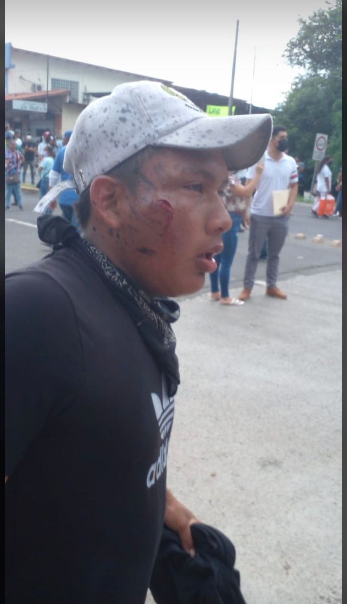 Martes 19 de julio del 2022
Santiago de Veraguas
#veraguasprohibidoolvidar 
Imagen real.