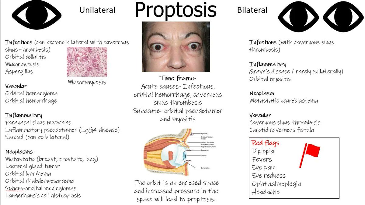 Peripheral Edema Differential Diagnosis Framework Grepmed My XXX Hot Girl