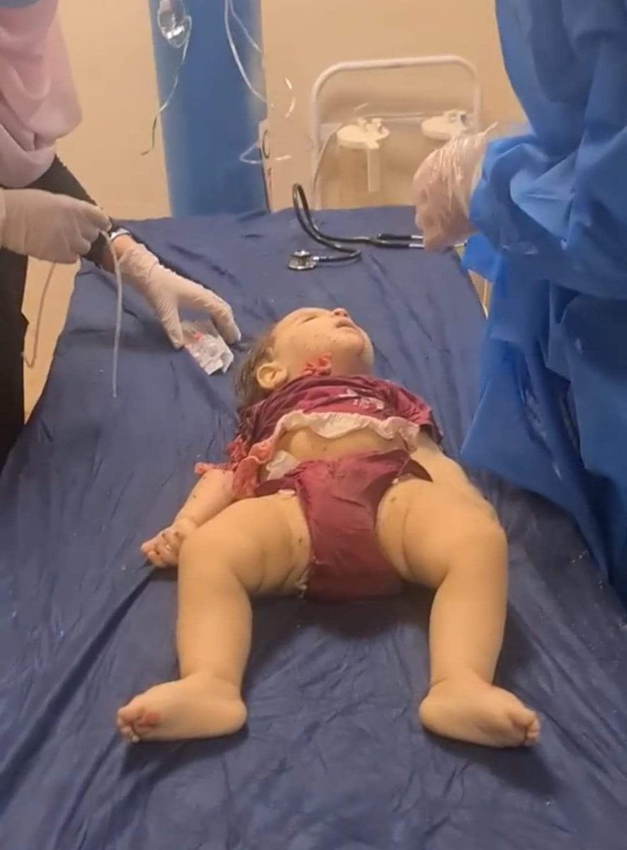 A_bablii's tweet photo. This baby was playing and was very happy
 But your fu**** missiles cut off her happiness and moved to the graves, you are unfortunate monsters.
Till when Kurdish civilians die for no reason, till when the Turkish government will you keep on its attack‼️
Till whennn!
#القصف_التركي https://t.co/CDfmDxYa92