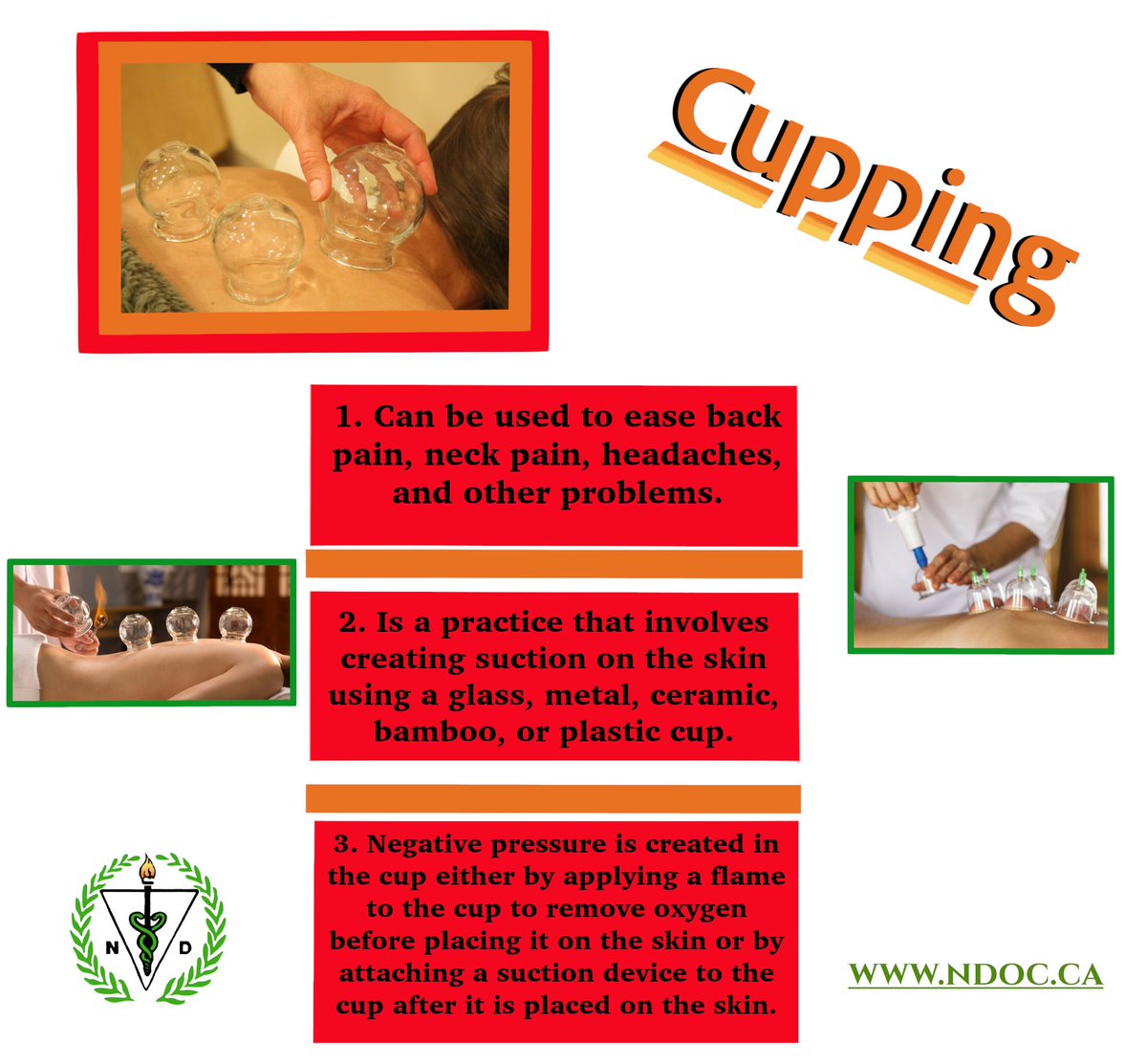 #cupping #holistic #holistichealing #holisticmeanswhole #natural #naturopathy #naturopathic #wellnessjourney #healthy #healthbenefits