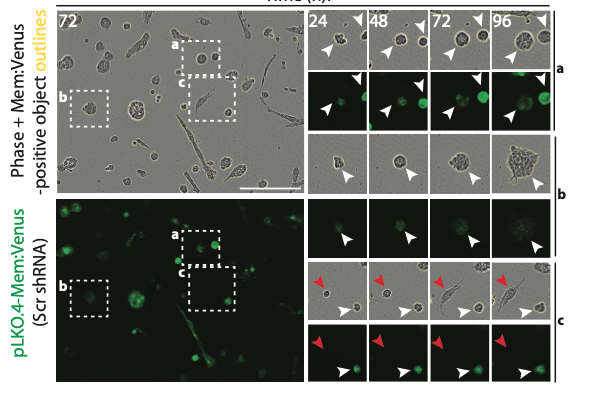 "The small GTPase ARF3 controls metastasis and invasion modality by regulating N-cadherin levels"
#RefereedPreprint
Emma Sandilands, @DavidBryantLab et al 

eeb.embo.org/doi/10.1101/20…