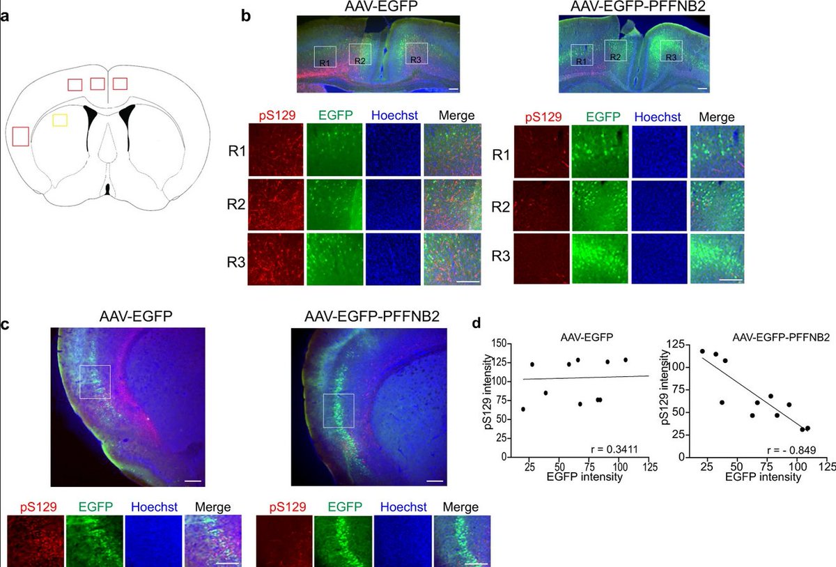 ScienceofPD's tweet photo. New tool - researchers generate nanobodies that preferentially bind to #Parkinsons-associated α-synuclein fibrils, but not α-synuclein monomers; Potential for "therapeutic development in α-syn-related pathogenesis"?
https://t.co/aOQbAjECuS https://t.co/poGywzXsac