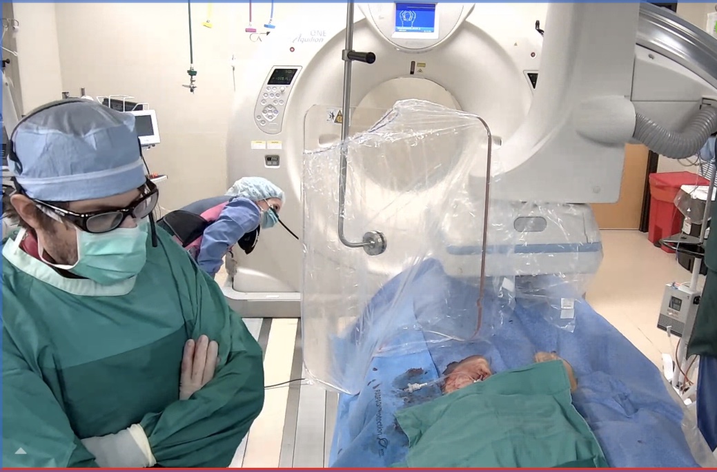 EPIC - Emory Percutaneous Intervention Course (@epicsec) on Twitter photo Many thanks to the fabulous team <a href="/wellspan/">WellSpan Health</a> York Hospital for broadcasting a complex LAA occlusion using <a href="/AbbottCardio/">Abbott Cardiovascular</a> Amulet on <a href="/AvailMedsystems/">Avail Medsystems</a>. Register for EPIC 2022 to see Emory trained Drs. Brian Schuler and <a href="/StewartBentonMD/">Stewart Benton, MD</a> use real time CT to assess the implant. Many thanks to the fabulous team <a href="/wellspan/">WellSpan Health</a> York Hospital for broadcasting a complex LAA occlusion using <a href="/AbbottCardio/">Abbott Cardiovascular</a> Amulet on <a href="/AvailMedsystems/">Avail Medsystems</a>. Register for EPIC 2022 to see Emory trained Drs. Brian Schuler and <a href="/StewartBentonMD/">Stewart Benton, MD</a> use real time CT to assess the implant.
