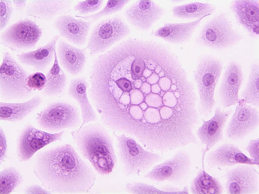 Lifescience, 10 milioni per BetaGlue Technologies dlvr.it/SVCl5F