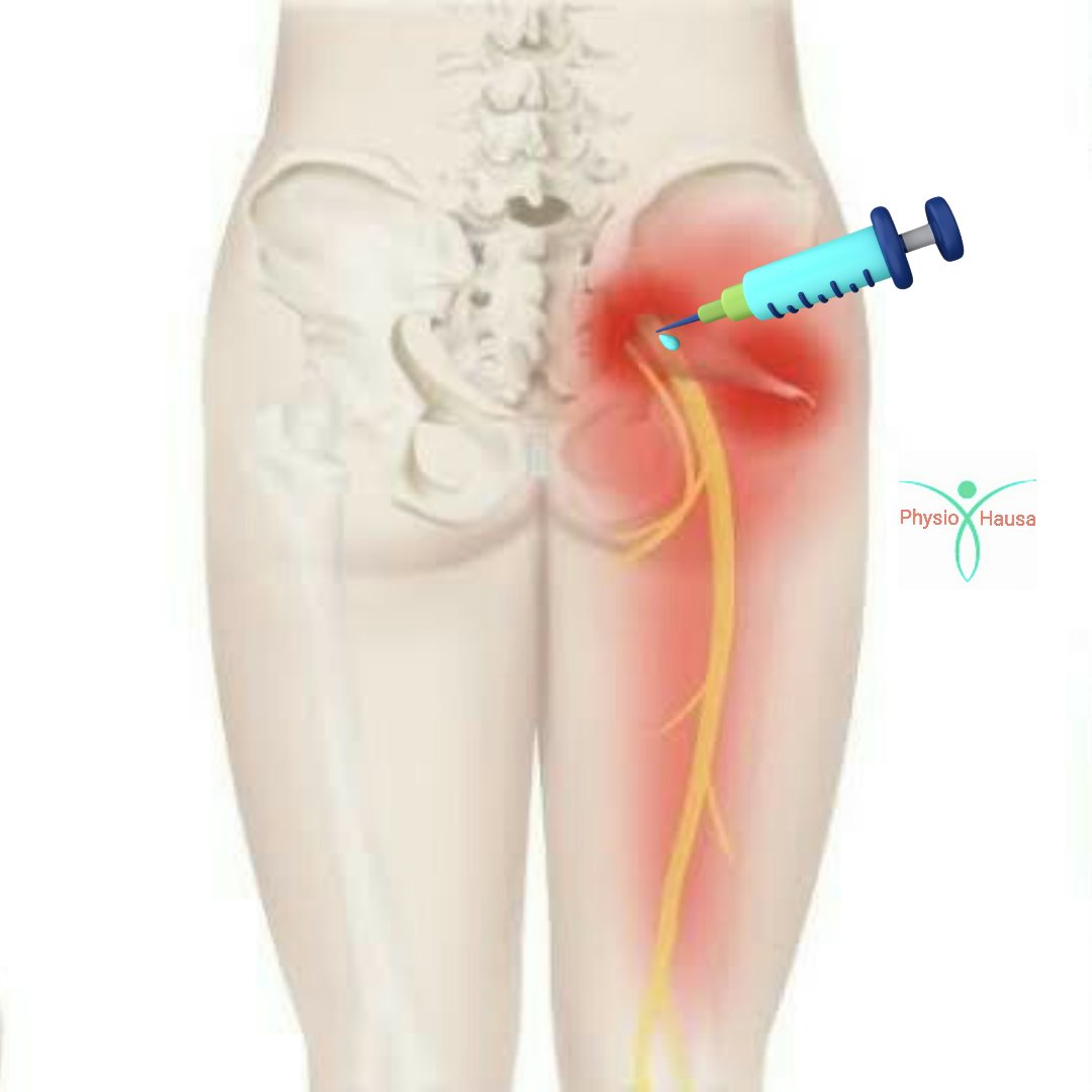 BBGaya's tweet photo. Meet #PhysiotherapyHausa  here:
Ka san dalilin shanyewar ƙafa bayan allura ɗuwawu?
https://t.co/ICUzbgRINC

#physio https://t.co/fEBpqrEphz