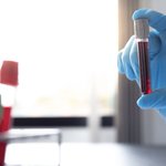 Photo by Hemochromatosis United States (@ironoverloadUS)