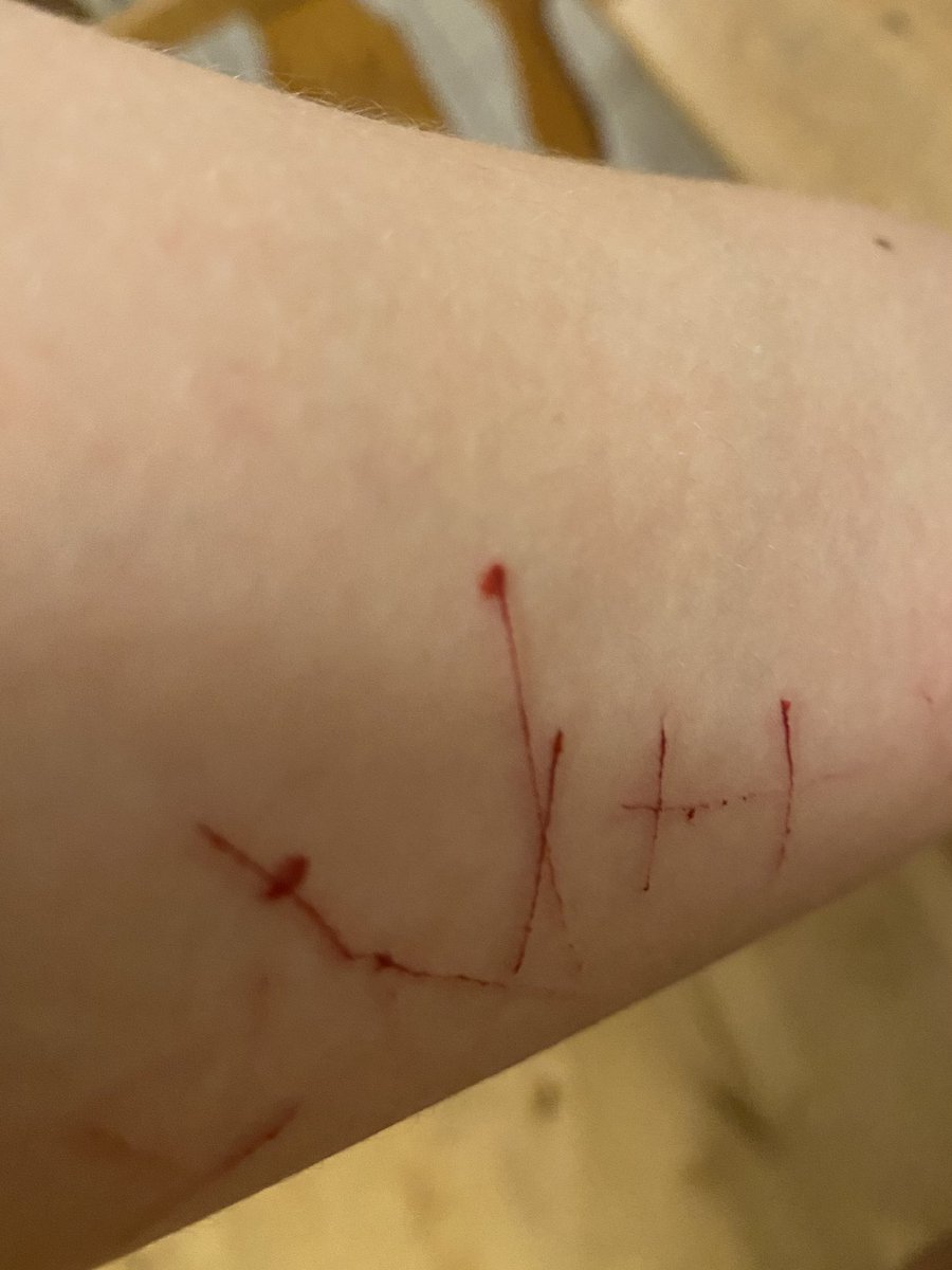 DignanEnjoyer's tweet photo. TW

i failed at doing a heart its too small idk. i thought i wouldnt relapse but then she had to snap me that she doesn't like me like that after making out with me multiple times yesterday

shtwt styrotwt catscratchtwt barcodetwt https://t.co/ooUpZEUpT0