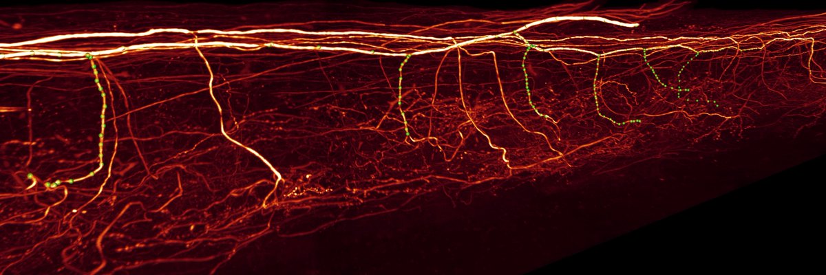 Reviewer:  the sprouting of axon collaterals at nodes of Ranvier cannot be visualized.

Me: Yes, they can. I see them everywhere, and you can as well if you have a better computer screen.