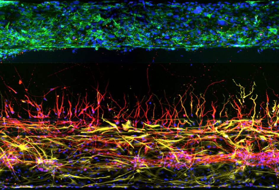 MIMETAS_3D's tweet image. An image of a neurovascular unit developed in the OrganoPlate® using hCMEC.d3 cells. Have a human tissue or disease model you want to create? Let our experts do it for you: lnkd.in/e4U2Kcww #bbb #humantissuemodel #modeldevelopment #customassay