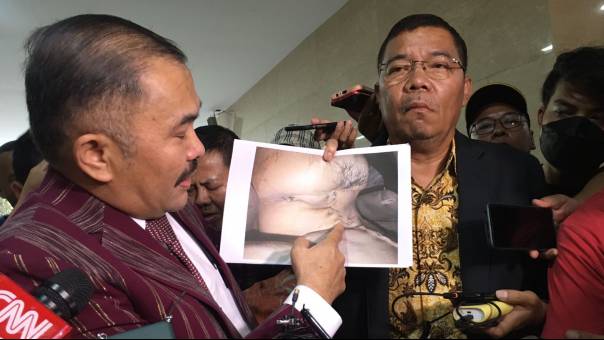 KompasTV's tweet photo. Ketika Para Jenderal Polri Terpesona Tak Bisa Membantah Ditunjukkan Bukti Penganiayaan Brigadir J https://t.co/rJmBUJzqgS https://t.co/8hD64tngdj