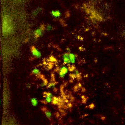 just imaged so many beautiful plasma cells in living bone marrow 😍 so excited to learn how much Ca2+ is in their cytoplasm (the green bodies)
#immunesystem #bcells #antibodies #plasmacells #calcium #bonemarrow #twophoton #microscopy