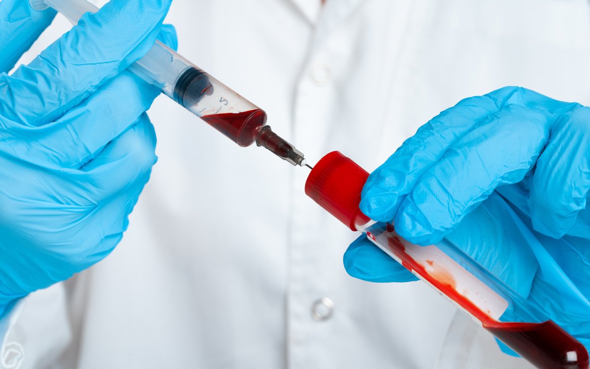 A single gene therapy injection could dramatically reduce the bleeding risk faced by people with #haemophilia B, finds a landmark study by Prof Pratima Chowdary &amp; Prof Amit Nathwani <a href="/uclcancer/">UCL Cancer Institute</a> <a href="/uclmedsci/">UCL Faculty of Medical Sciences</a> <a href="/RoyalFreeNHS/">Royal Free London</a> <a href="/FreelineLife/">FreelineLife</a> in the <a href="/NEJM/">NEJM</a>: ucl.ac.uk/news/2022/jul/…