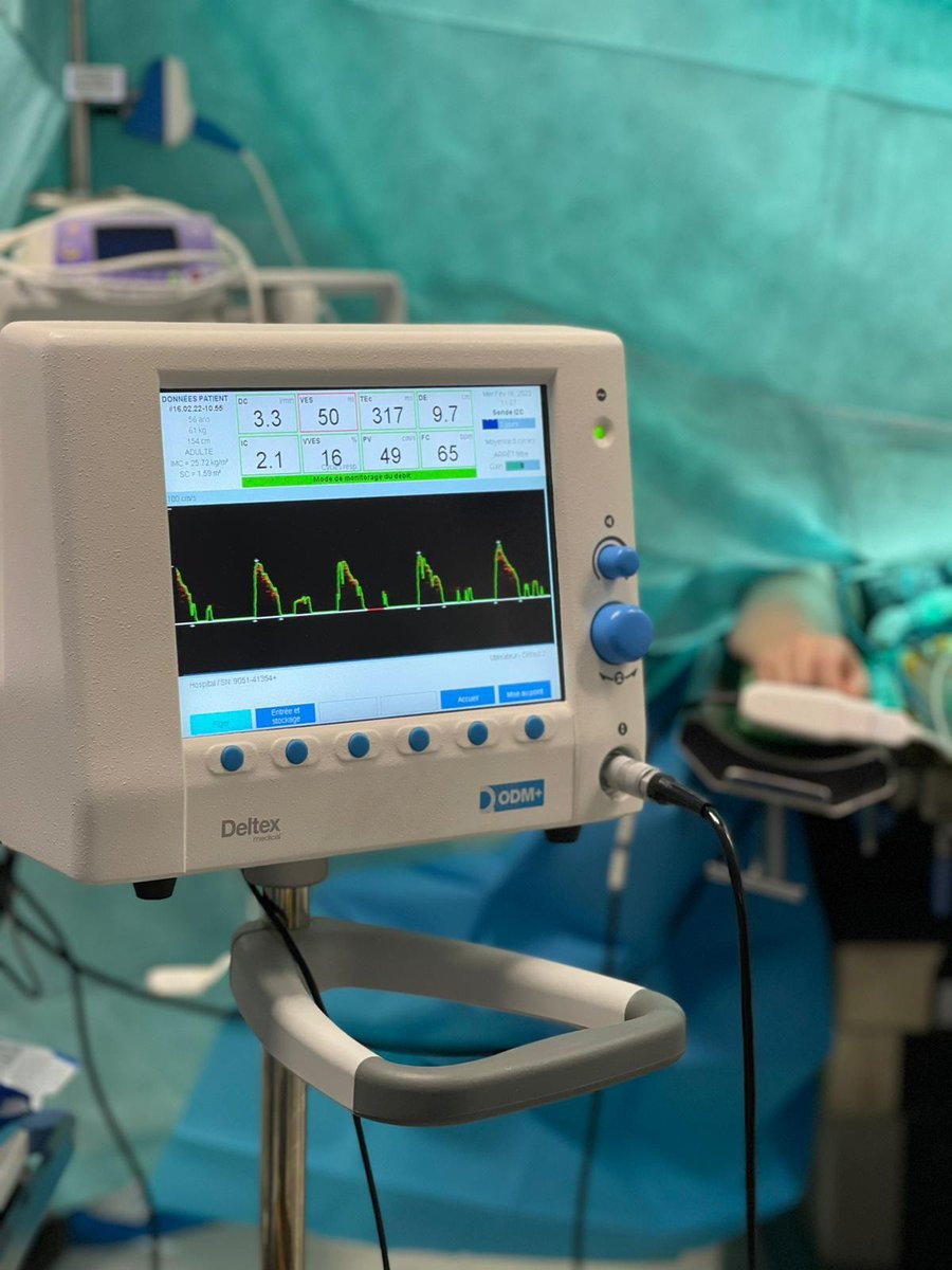 📸 Connaissez-vous la prise d'instantanés sur le doppler œsophagien ? 

Une maîtrise précise des évolutions 📈 de la prise en charge du patient.
Les RFE démontrent l'utilité et l'efficacité d'un tel monitorage pour la réhab. améliorée. 

🫵 Et vous, vous prenez des instantanés❓