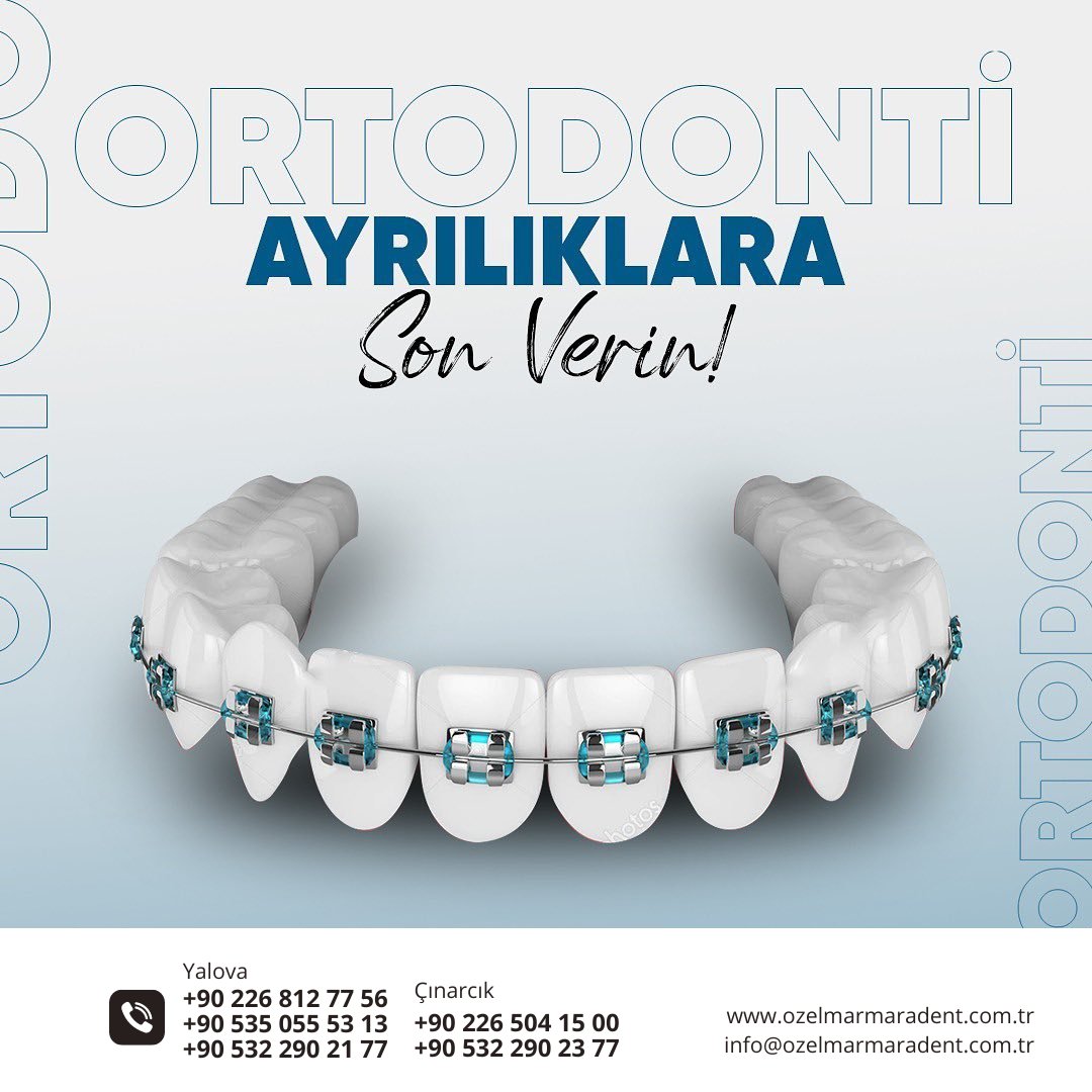 Sağlıklı dişler ve mutlu gülüşler dileriz. ozelmarmaradent.com.tr

📌Yalova Şube
☎️ +90 226 812 77 56
☎️ +90 535 055 53 13
☎️ +90 532 290 21 77

📌Çınarcık Şube
☎️ 0 226 504 15 00
☎️ 0 532 290 23 77
.
.
..
#ozelmarmaradent #dişapsesi #20likdiş #diştaşıtemizliği #zirkonyum